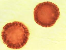 Image result for Kirkiaceae