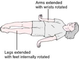 Comatose Patients Seizures Nbme Pediatrics Shelf Exam Neurology Flashcards Memorang