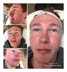 Positive Reflections