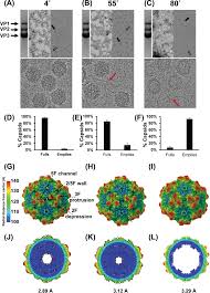 Image result for Gold 1996 AAV