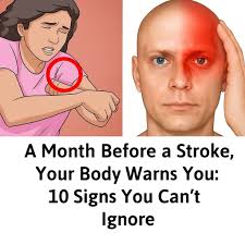 Stroke warning signs to not ignore