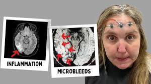 Surviving The Unexpected At Fifteen Years Sober