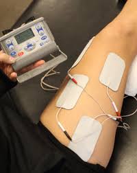 Image result for Electrical Stimulation Therapy