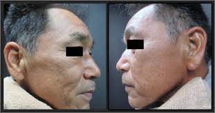 Clinical Case Reports: Vol 10, No 10