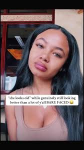 Where Did Brooklyn Queen Get That Lip Scar from