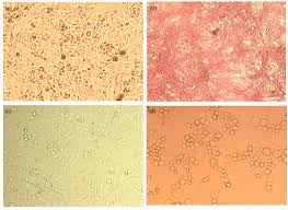All people in vero channel will hear the voice from 438.500 ,if any people answers in vero channel, it will tranmit to 438.500mhz,so user at 438.500mhz can hear the voice from vero channel. In Vitro Analysis Of Phytochemicals Epicatechin Naringenin Myricetin Against Hep3b Cell Lines And Vero Cell Lines Scialert Responsive Version