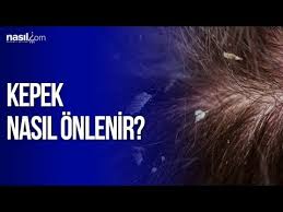 Kepek Nasil Onlenir Sac Bakim Nasil Com Youtube