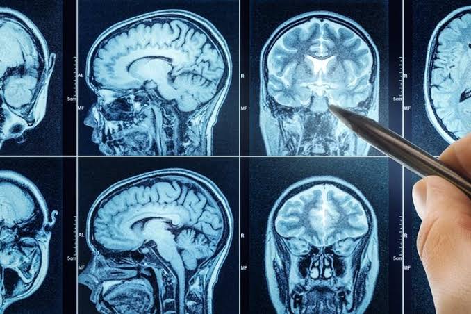 The Mystery of Consciousness: New Study Challenges 'Brain-Death' Narrative|  National Catholic Register