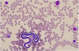 Green's intersect at the ankle. Frontiers Incidental Detection Of Onchocerca Microfilariae In Donkeys Equus Asinus In Italy Report Of Four Cases Veterinary Science