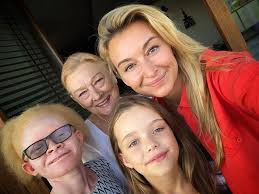 Skutki uboczne picia wody z cytryną (z 6). Martyna Wojciechowska Pokazala Swoja Druga Adoptowana Corke Kim Jest Tatu Kobieta Pl
