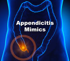 Emdocs Net Emergency Medicine Educationappendicitis Mimics Ed Focused Management Emdocs Net Emergency Medicine Education