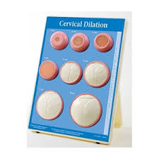 Cervical Dilation Easel Display