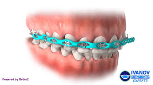 | page 2 of 125. Color Wheel Sky Blue Light Blue Braces Novocom Top