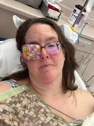 Amiodarone side effects and NSR maintenance