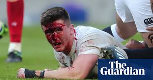 British health secretary matt hancock condemned unsubstantiated attacks from dominic cummings as he fought to save his career over claims he lied to boris johnson about coronavirus plans. Bloodied Tom Curry Channels Spirit Of Terry Butcher To Stake England Claim England Rugby Union Team The Guardian