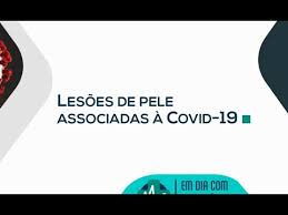 Em espanha têm aparecido vários casos de erupções cutâneas, sobretudo nos pés, de doentes que depois testam positivo. Em Dia Com A Saude Lesoes De Pele Associadas A Covid 19 Youtube