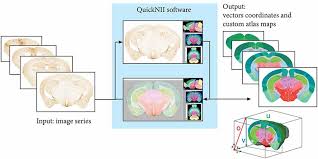 În lumea vegetală, liderii la categoria cantitate de proteine sunt: Frontiers Quint Workflow For Quantification And Spatial Analysis Of Features In Histological Images From Rodent Brain Frontiers In Neuroinformatics