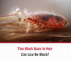 Teeny tiny little black bugs and they do like to swam on light colours walls and such. Tiny Black Bugs In Hair Getridofallthings Com
