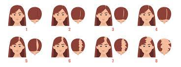 En effet, ce phénomène (alopécie androgénétique) est tout aussi héréditaire que la couleur mais la femme a un avantage sur l'homme. Perte De Cheveux Femme Comment La Soigner Efficacement Elithair