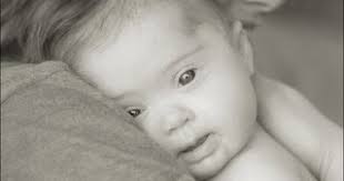 Centro Umbandista Lar de Caridade Luz do Amanhã: Síndrome de Down