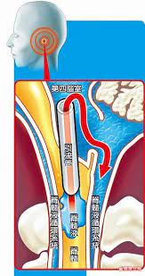 蔡智銘 詹智淵 連線報導 長期頭痛需埋首雙膝舒緩 原來是 脊髓空洞症 作祟 屏東一名陳姓攝影師十八歲車禍傷到腦部 導致脊髓液流入脊髓 引發 frosted flakes cereal box frosted flakes cereal frosted flakes