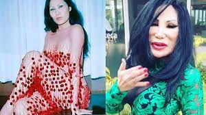 La impactante transformación de la artista mexicana desfigurada por las cirugías. Asi Era Lyn May Antes Del Tratamiento Que Le Transformo La Cara Fotos