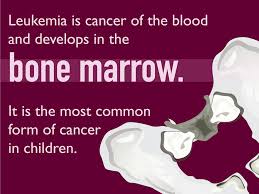 11 symptoms such as pallor,. Pediatric Leukemia Symptoms And Signs Dana Farber Cancer Institute