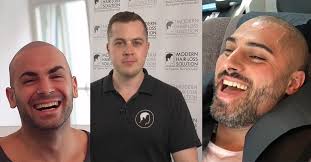 A small number of men have reported side effects taking finasteride, but that number seems to be less than 4%. Haarpigmentierung Modern Hair Loss Solution Home Facebook