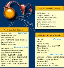 The Radiology Assistant Roadmap To Evaluate Ovarian Cysts