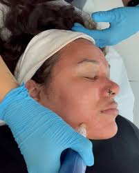 Olivia Nolan (@livnolanesthetics) • Instagram photos and videos