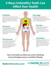6 Health Issues Caused By Bad Oral Health Healthissues Badoralhealth Unhealthyteeth Affectyourhealth Oral Health Oral Health