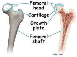 Image result for Pediatric Limp