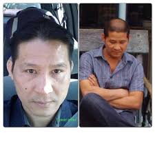 Hair products will help your regrow new hair