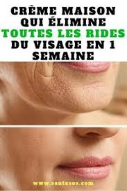 7 Exercices De Rides Du Visage Qui Peuvent Prendre Des Annees Soin Visage Maison Creme Visage Maison Creme Maison
