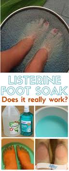 does the listerine foot soak really