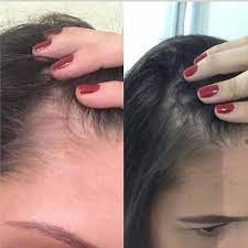 Naara Em Capsulas Hair And Nails Colageno Hidrolisado Mercado Livre Published on nov 27, 2006. naara em capsulas hair and nails colageno hidrolisado