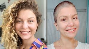 Bárbara Borges radicaliza e adota visual careca: 'Romper medo de rejeição' 