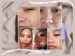 Kulit wajah jika sudah kering biasanya akan terasa kasar sehingga anda harus menggunakan pelembab wajah untuk kulit kering. Safira Nys Skincare Routine Untuk Kulit Sensitive Acne Prone Berjerawat