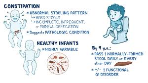 Image result for Pediatric Constipation