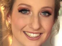 Help Ella With her recovery