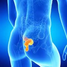 Image result for Proctitis