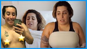 Schon nach wenigen monaten sind die lichten stellen bei den meisten patienten nicht wiederzuerkennen. Meine Brust Op Vorher Nachher Jolina Mennen Youtube