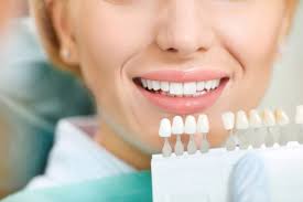 Good value easy to use. All You Need To Know About Teeth Whitening Positive Dental Belconnen