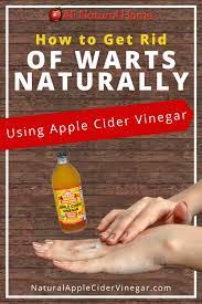 So how long does it take for apple cider vinegar to work on warts? How To Get Rid Of Warts Naturally With Apple Cider Vinegar All Natural Home