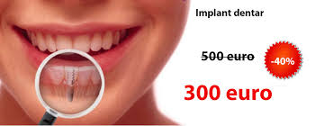 « implant l'implant permet de remplacer une dent manquante de manière très esthétique avec un résultat très confortable car la dent est fixe et indépendante de ses. Implant Dentar Bucuresti Pret 300 Euro Oferta Implant Dentar 2020 2021