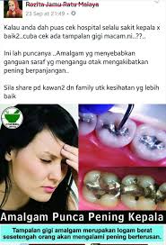Pening kepala mengambarkan rasa kepala yang tidak selesa. Tampalan Gigi Punca Pening Kepala Media Hub M