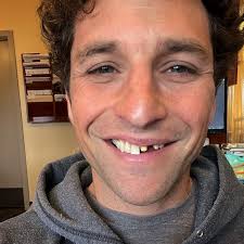 So hot rn. #teethmodelsofinstagram While it would have been a good look for  Halloween, huge thanks Mark, Tony, and team at Ochoco Dental for sparing me  (and everyone else) from seeing this