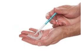Blanqueamiento ambulatorio (en casa ) primero hacemos una limpieza profunda en el consultorio , si es necesario con ultrasonido. Blanqueamiento Dental En Casa Clinica Dental En Madrid Dr Ferrer