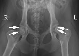 It is subdivided into the greater pelvis and lesser pelvis. Tips Techniques For Pelvic Radiography Clinician S Brief