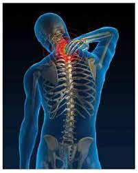Spondiloza cervicala sau osteoartrita cervicala este o afectiune foarte des intalnita, incidenta acesteia fiind crescuta la persoanele in varsta si la cele care petrec mult timp stand pe scaun. Spondiloza Cervicala Cauze Simptome Si Cum Tratam Durerea Spondiloza Cervicala Reprezinta O Afectiune Foarte Intalnita La Persoanele De Peste 40 De Ani Cu Precadere Sedentare Si Supraponderale Insa Nu Reprezinta O Conditie